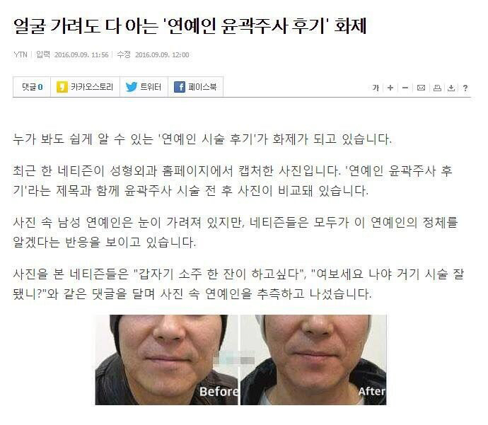 익명성 보장 안되는 윤곽주사 후기
