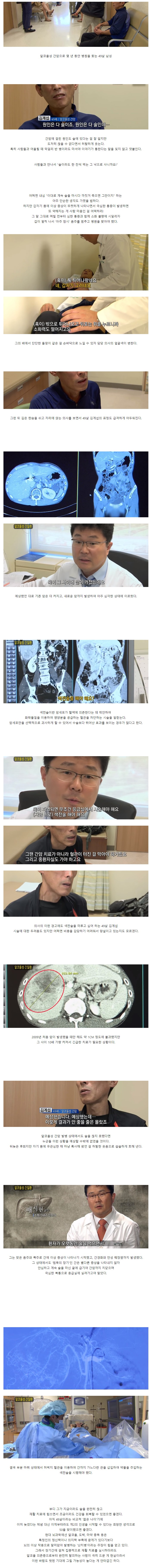 간암에 걸렸는데도 술을 못끊는사람