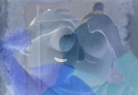 이마 탁 소리 나는 영상